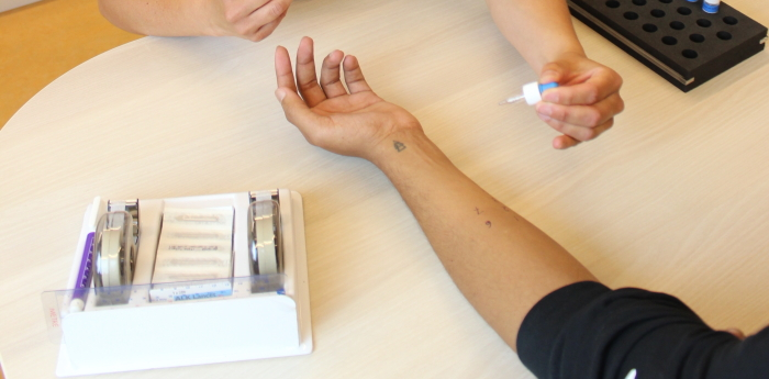 Huidpriktest op de onderarm